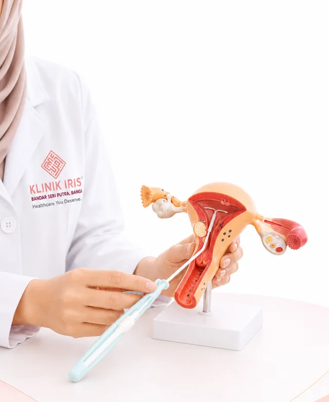 IUCD di Klinik Iris